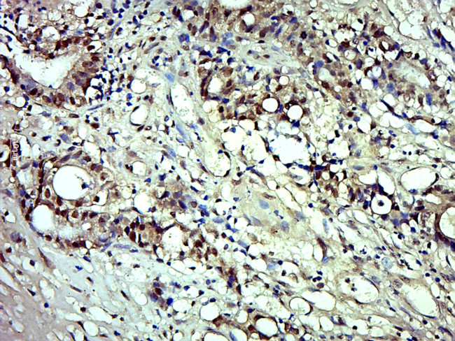 Phospho-MDM2 (Ser166) Antibody in Immunohistochemistry (Paraffin) (IHC (P))