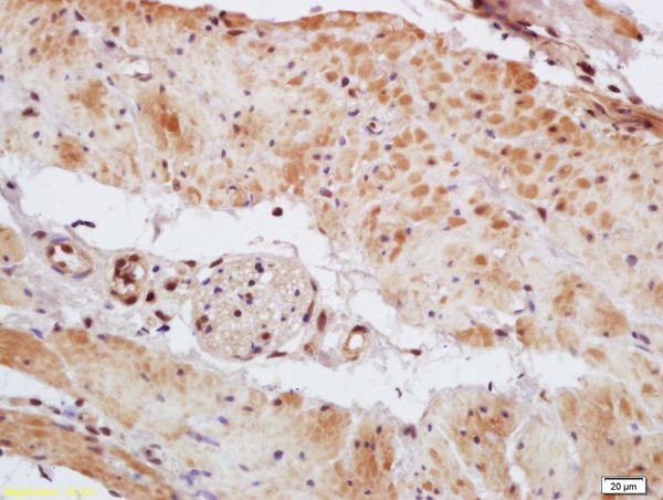 Phospho-MEF2A (Thr312) Antibody in Immunohistochemistry (Paraffin) (IHC (P))