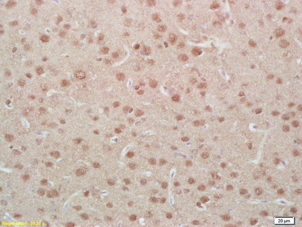 Phospho-MEF2A (Ser408) Antibody in Immunohistochemistry (Paraffin) (IHC (P))