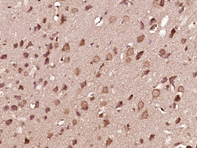 Phospho-MEK1 (Thr286) Antibody in Immunohistochemistry (Paraffin) (IHC (P))