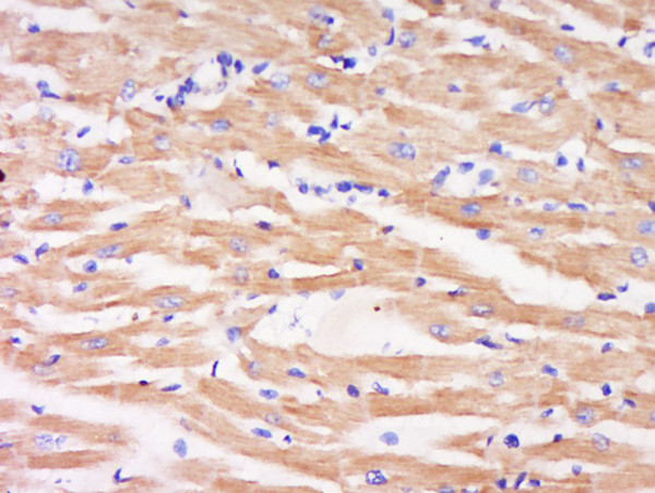 Phospho-MEK6 (Ser202) Antibody in Immunohistochemistry (Paraffin) (IHC (P))
