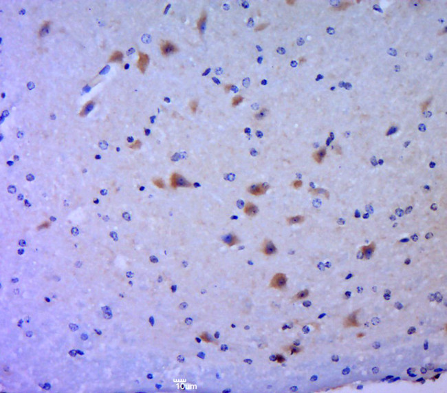 Phospho-MLK3 (Thr277, Ser281) Antibody in Immunohistochemistry (Paraffin) (IHC (P))