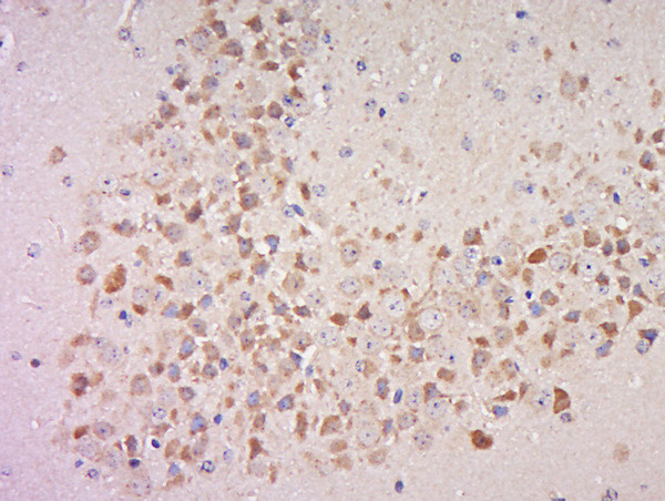 Phospho-MSK1 (Ser360) Antibody in Immunohistochemistry (Paraffin) (IHC (P))