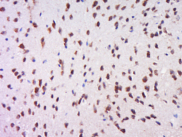 Phospho-MSK1 (Ser212) Antibody in Immunohistochemistry (Paraffin) (IHC (P))