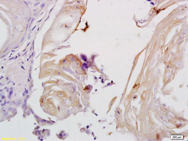 Phospho-MYPT1 (Thr853) Antibody in Immunohistochemistry (Paraffin) (IHC (P))