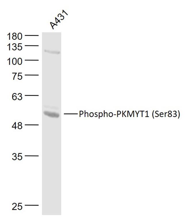 Phospho-Myt1 (Ser83) Antibody in Western Blot (WB)