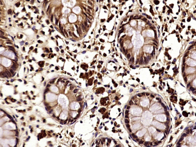 Phospho-NDRG1 (Thr346) Antibody in Immunohistochemistry (Paraffin) (IHC (P))