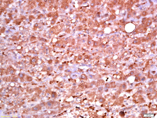 Phospho-PDK1 (Ser241) Antibody in Immunohistochemistry (Paraffin) (IHC (P))