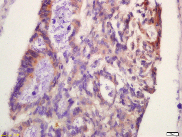 Phospho-PFK2 (Ser467) Antibody in Immunohistochemistry (Paraffin) (IHC (P))