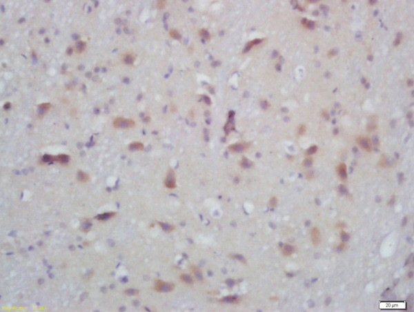 Phospho-PKC alpha/beta 2 (Thr638, Thr641) Antibody in Immunohistochemistry (Paraffin) (IHC (P))