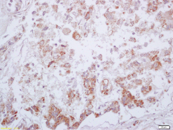 Phospho-PKM2 (Tyr105) Antibody in Immunohistochemistry (Paraffin) (IHC (P))