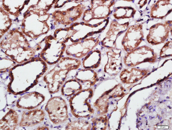 Phospho-PKR (Thr451) Antibody in Immunohistochemistry (Paraffin) (IHC (P))