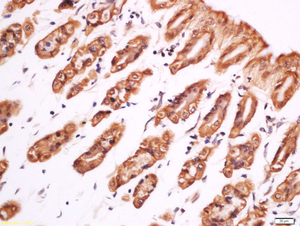 Phospho-PLC gamma 1 (Tyr783) Antibody in Immunohistochemistry (Paraffin) (IHC (P))