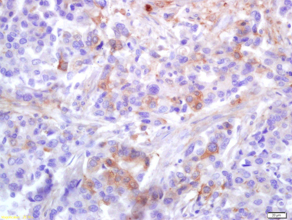 Phospho-PLK1 (Thr210) Antibody in Immunohistochemistry (Paraffin) (IHC (P))