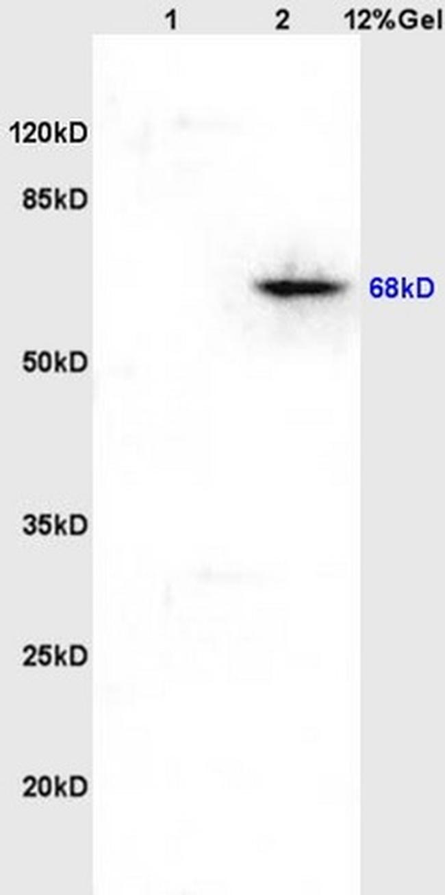 Phospho-Paxillin (Tyr118) Antibody in Western Blot (WB)