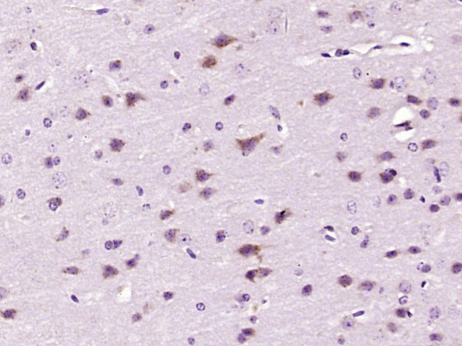 Phospho-p90RSK (Ser380) Antibody in Immunohistochemistry (Paraffin) (IHC (P))