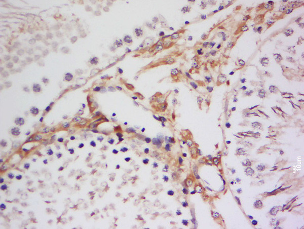 Phospho-p90RSK (Thr359, Ser363) Antibody in Immunohistochemistry (Paraffin) (IHC (P))