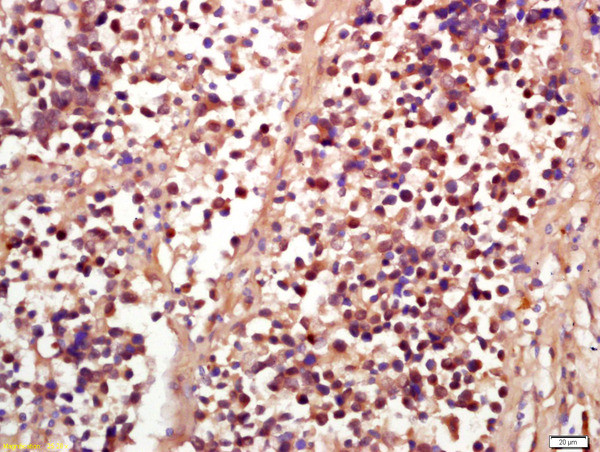 Phospho-RSK2 (Ser227) Antibody in Immunohistochemistry (Paraffin) (IHC (P))