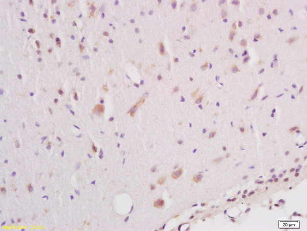 Phospho-B-Raf (Ser602) Antibody in Immunohistochemistry (Paraffin) (IHC (P))