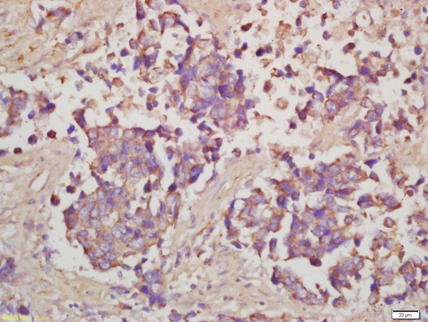 Phospho-RPS6 (Ser240, Ser244) Antibody in Immunohistochemistry (Paraffin) (IHC (P))