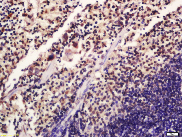 Phospho-SATB1 (Ser47) Antibody in Immunohistochemistry (Paraffin) (IHC (P))