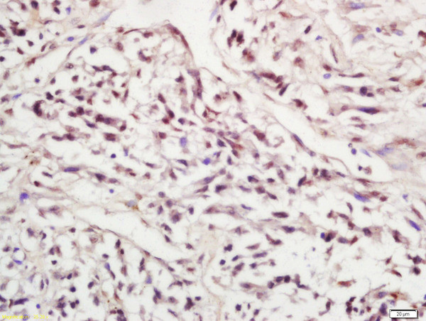 Phospho-SIRT1 (Ser47) Antibody in Immunohistochemistry (Paraffin) (IHC (P))