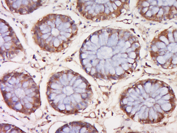 Phospho-MEK4 (Ser257, Thr261) Antibody in Immunohistochemistry (Paraffin) (IHC (P))