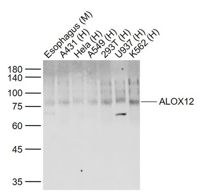 ALOX12 Antibody in Western Blot (WB)