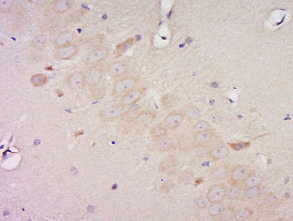 Phospho-Pyk2 (Tyr881) Antibody in Immunohistochemistry (Paraffin) (IHC (P))