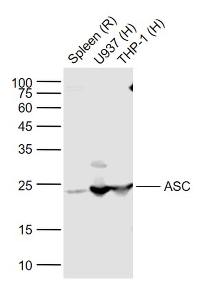 ASC Antibody in Western Blot (WB)