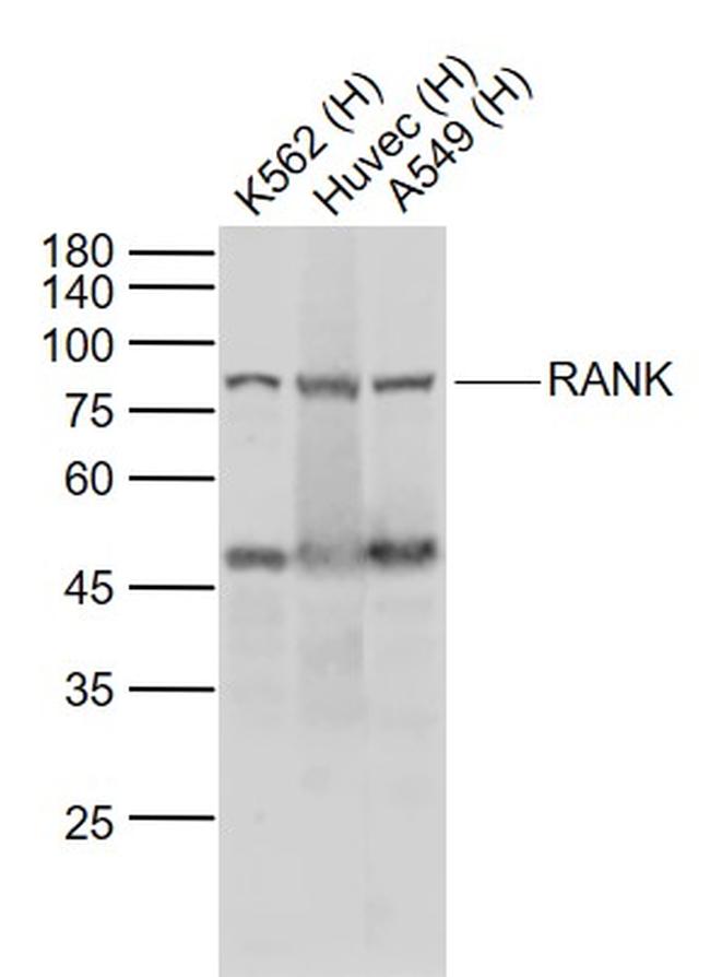 RANK Antibody in Western Blot (WB)