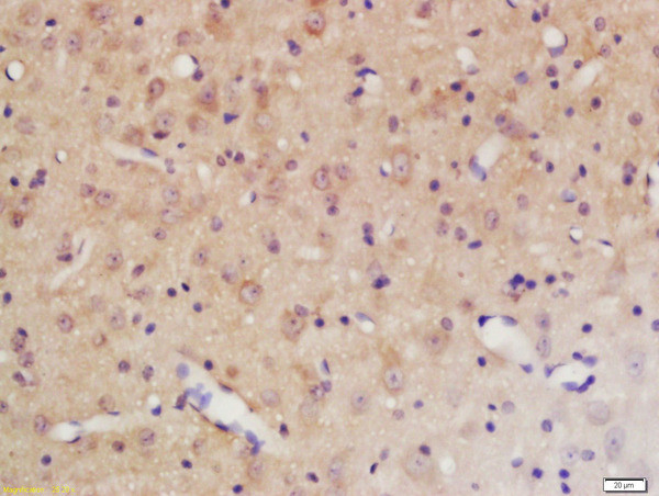 Phospho-PTPN11 (Tyr584) Antibody in Immunohistochemistry (Paraffin) (IHC (P))
