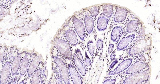 Phospho-SMC1 (Ser360) Antibody in Immunohistochemistry (Paraffin) (IHC (P))