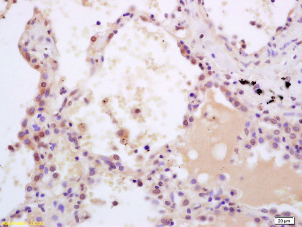 Phospho-SHC (Tyr349, Tyr350) Antibody in Immunohistochemistry (Paraffin) (IHC (P))