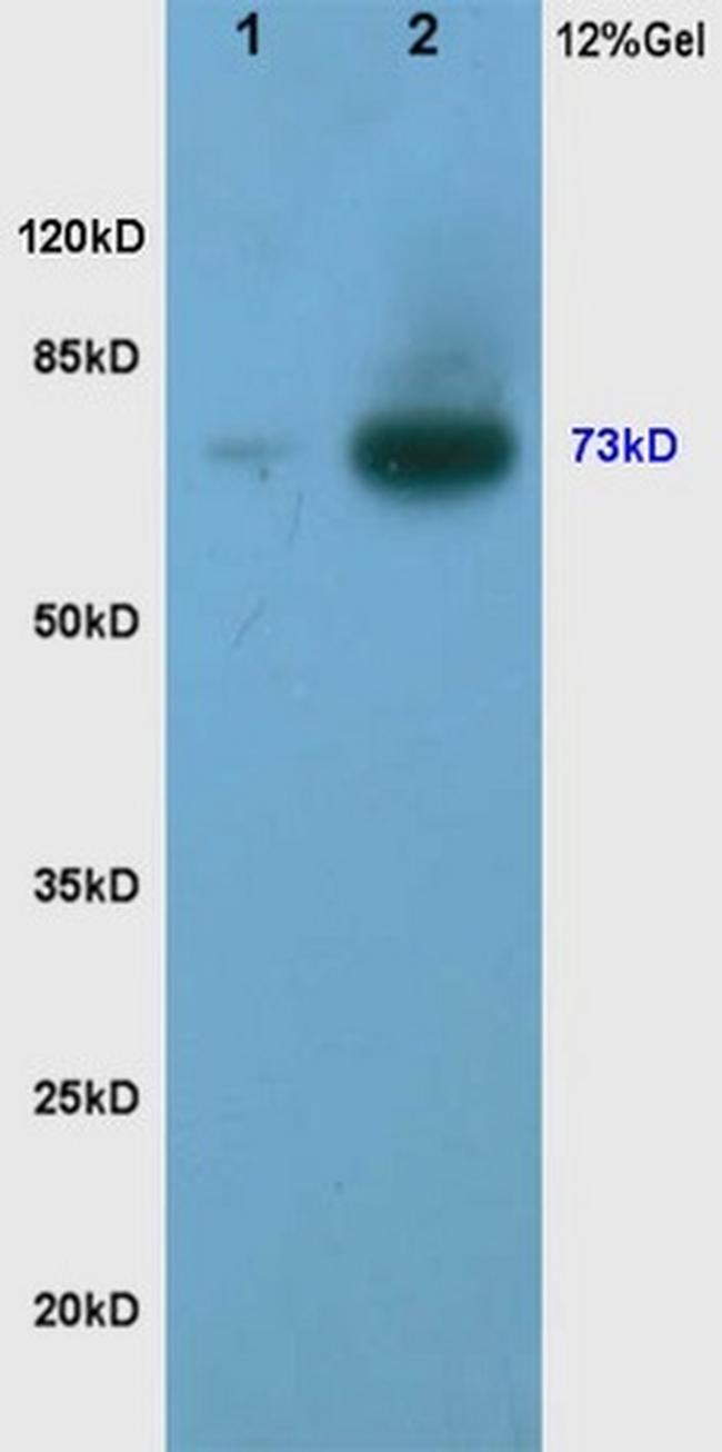 Phospho-TORC2 (Ser171) Antibody in Western Blot (WB)
