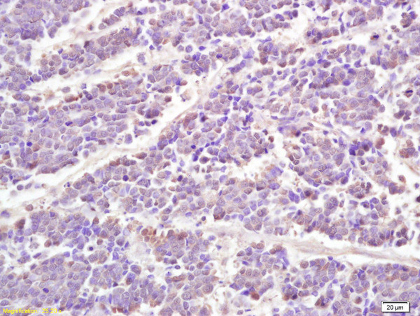 Phospho-STAT1 (Ser727) Antibody in Immunohistochemistry (Paraffin) (IHC (P))