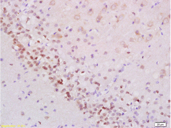 Phospho-Stat2 (Tyr690) Antibody in Immunohistochemistry (Paraffin) (IHC (P))