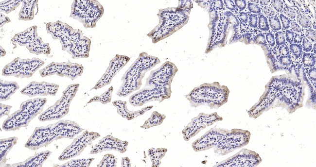 Phospho-Stat4 (Tyr693) Antibody in Immunohistochemistry (Paraffin) (IHC (P))