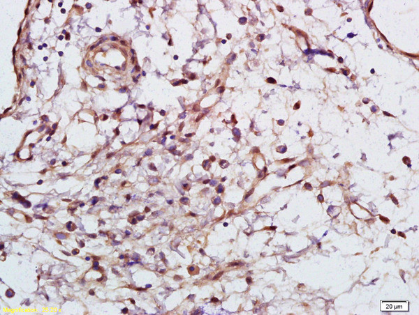 Phospho-Syk (Tyr525, Tyr526) Antibody in Immunohistochemistry (Paraffin) (IHC (P))
