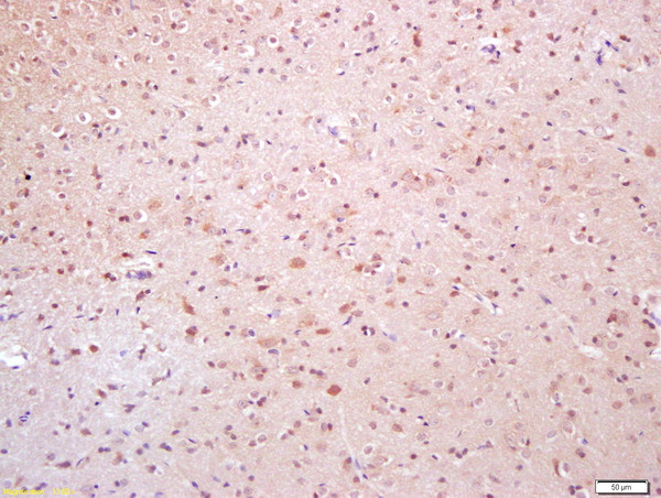 Phospho-TAK1 (Thr184) Antibody in Immunohistochemistry (Paraffin) (IHC (P))