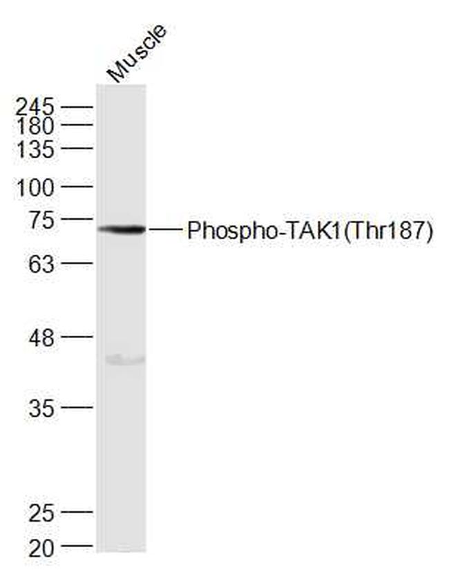 Phospho-TAK1 (Thr187) Antibody in Western Blot (WB)