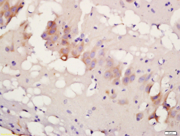Phospho-TBK1 (Ser172) Antibody in Immunohistochemistry (Paraffin) (IHC (P))