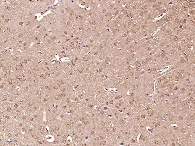 Phospho-Tuberin (Thr927) Antibody in Immunohistochemistry (Paraffin) (IHC (P))