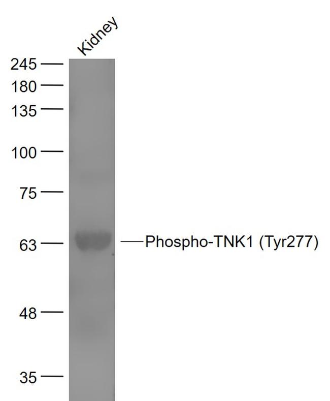 Phospho-TNK1 (Tyr277) Antibody in Western Blot (WB)