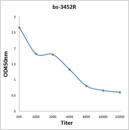 Phospho-Rb/P105 RB (Thr821) Antibody in ELISA (ELISA)