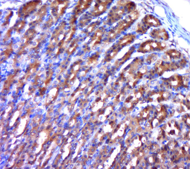 Phospho-MAP3K8 (Ser400) Antibody in Immunohistochemistry (Paraffin) (IHC (P))