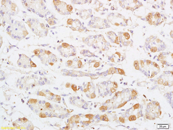 Phospho-MAP3K8 (Thr290) Antibody in Immunohistochemistry (Paraffin) (IHC (P))