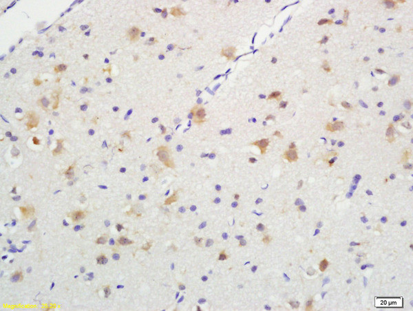 Phospho-TrkA (Tyr496) Antibody in Immunohistochemistry (Paraffin) (IHC (P))