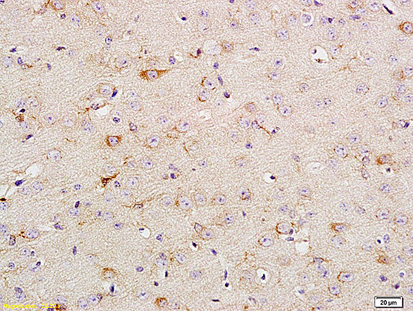 Phospho-TrkA (Tyr680, Tyr681) Antibody in Immunohistochemistry (Paraffin) (IHC (P))