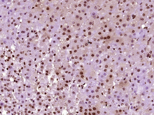 Phospho-TH (Ser31) Antibody in Immunohistochemistry (Paraffin) (IHC (P))